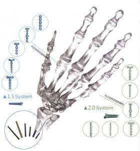 China Orthopedic Implant Bone Fracture Titanium Locking Plate For Hands Foot wholesale