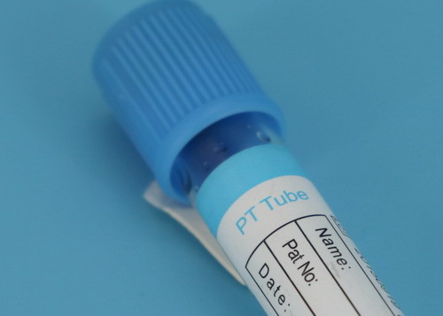 China Medical Disposable Centrifuge Tube / Blood Collection Tube CE ISO Approved wholesale