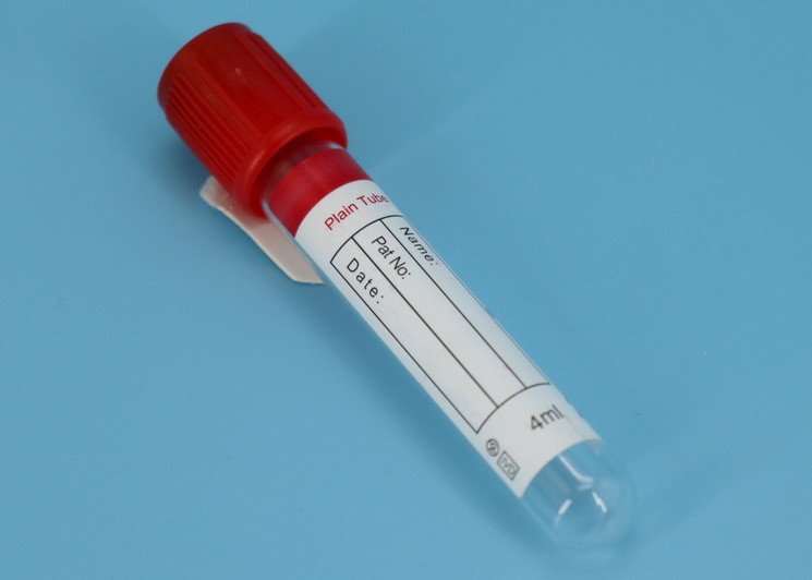 China Blood and Urine Cryogenic Vials Transport Kit / Laboratory Medical Ambient Kit wholesale