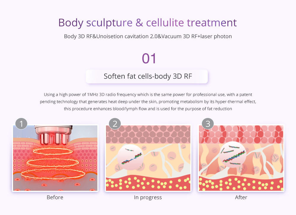 Unoisetion 6 In 1 40k Cavitation Ultrasonic Lipo Laser Body Sculpting Machine