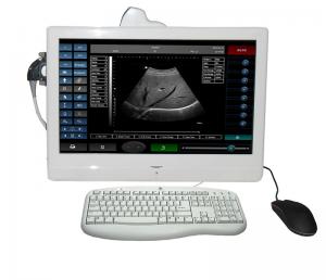 China tablet touch screen Portable ultrasound scanner diagnostic machine wholesale