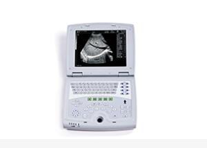 Mobile Ultrasound Machine Digital Laptop Ultrasound Scanner with 100 Frames