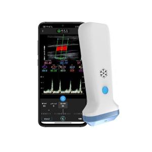 China 12.6cm Portable Color Doppler Ultrasound Scanner For Healthcare Professionals wholesale