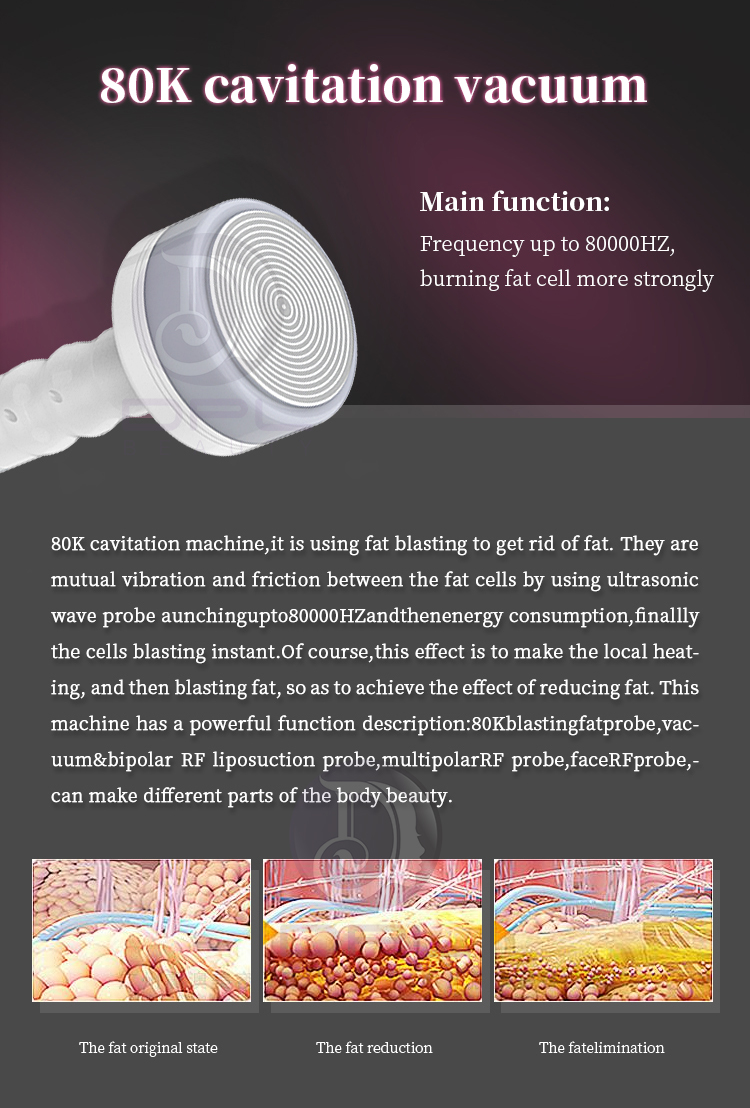Radio Frequency S Shape 80k Ultrasonic Cavitation Vacuum Massage Bipolar Rf Fast Slimming Machine