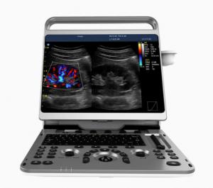 China Portable Cardiac Ultrasound Machine Chison EBit 50 16.5lbs on sale