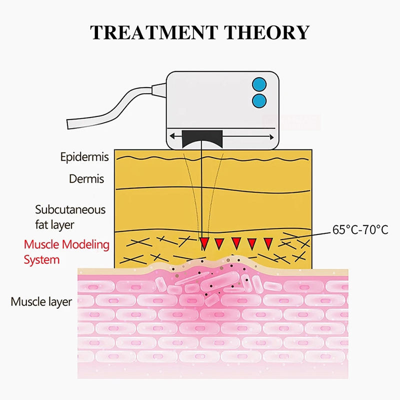 Rf Beauty Equipment For Face Household Beauty Skin Care And Freckle Radio Frequency Beauty Instrument
