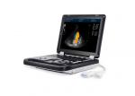 2 Probe Connectors Color Doppler Machine System Laptop Ultrasound Scanner With