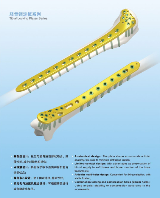 Plate and Screw Reconstruction L-Shaped Plates(L/R) Lower Limbs Titanium Implate