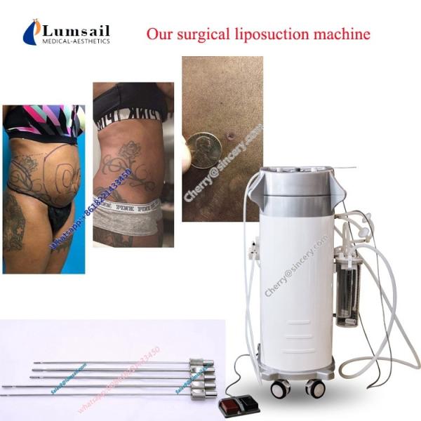 Fat Removal Surgical Liposuction Machine Weight Loss Cavitation Vacuum
