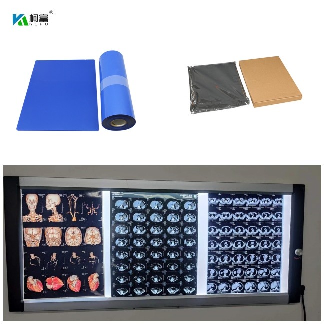 125/150/180 Microns Blue Medical Film Inkjet Perfect for Medical Imaging Equipment